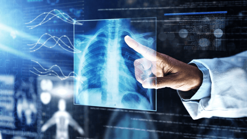 Doctor, healthcare or finger on xray hologram in tuberculosis virus, cancer analytics or asthma x ray at night. Futuristic, abstract or medical lungs scan for surgery planning or hospital woman help