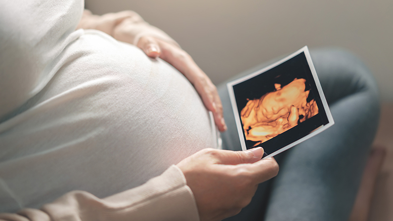Asian pregnant woman holding ultrasound 4d scan image, Expectation of a child and Maternity prenatal care and woman pregnancy concept.