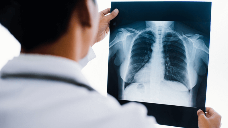 Radiology doctor examining at chest x ray film of patient at health care clinic