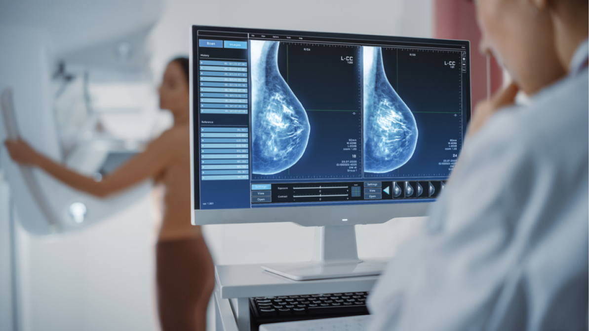Computer Screen in Hospital Radiology Room: Beautiful Multiethnic Adult Woman Standing Topless Undergoing Mammography Screening Procedure. Screen Showing the Mammogram Scans of Dense Breast Tissues.