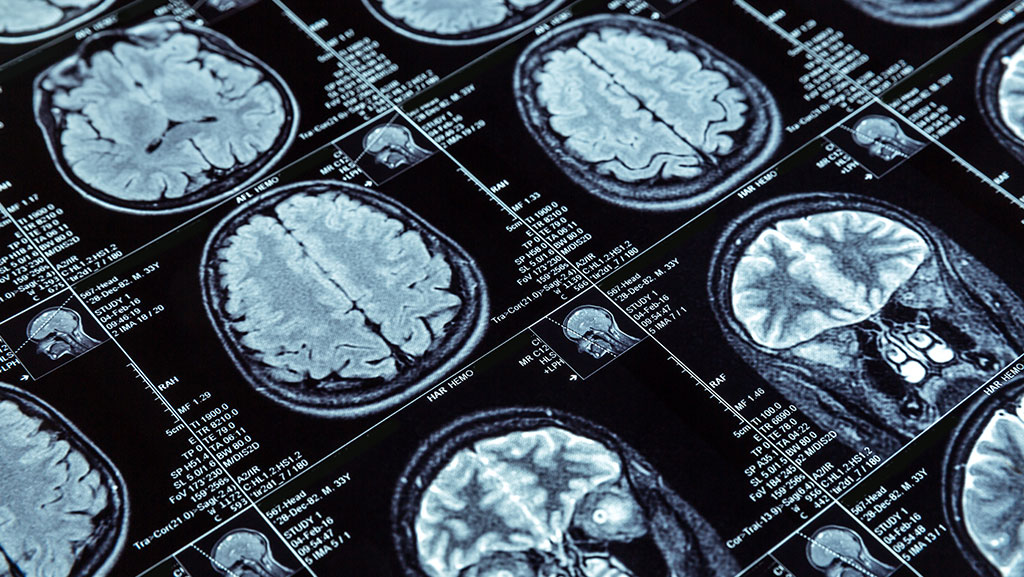 2-Standard-Terms-You’ll-See-&-What-They-Mean