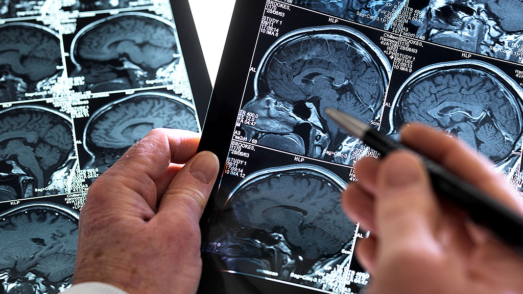 1-MRI-vs-fMRI-Key-Differences-Explained-in-Simple-Terms