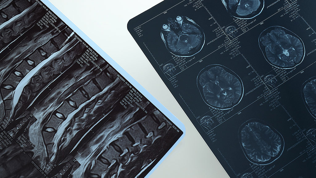 3-Practical-Scenarios-When-Each-Scan-Is-Used