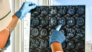 1-What-to-expect-during-an-MRI-with-Contrast